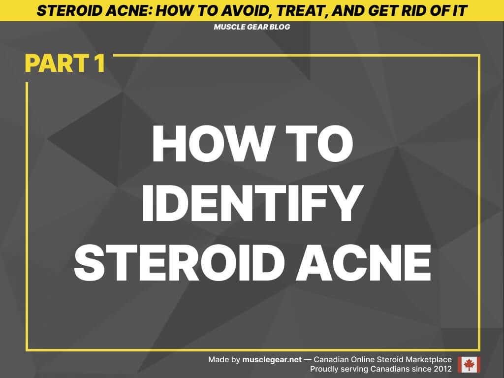 How to identify steroid acne